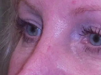 Plastic Surgery in San Antonio