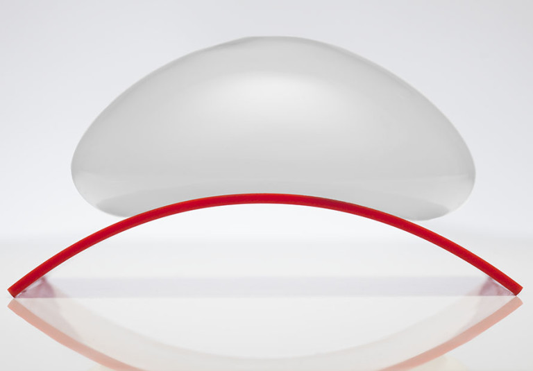 Ideal Implants breast augmentation