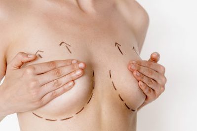 breast lift san antonio