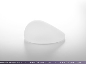 Gummy Bear” Breast Implants vs IDEAL IMPLANT
