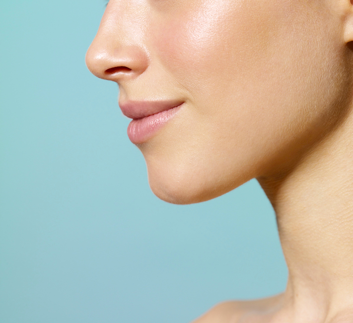 Chin Implants San Antonio